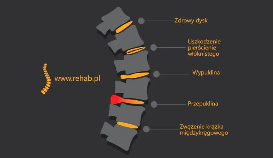 Ergonomia w pracy